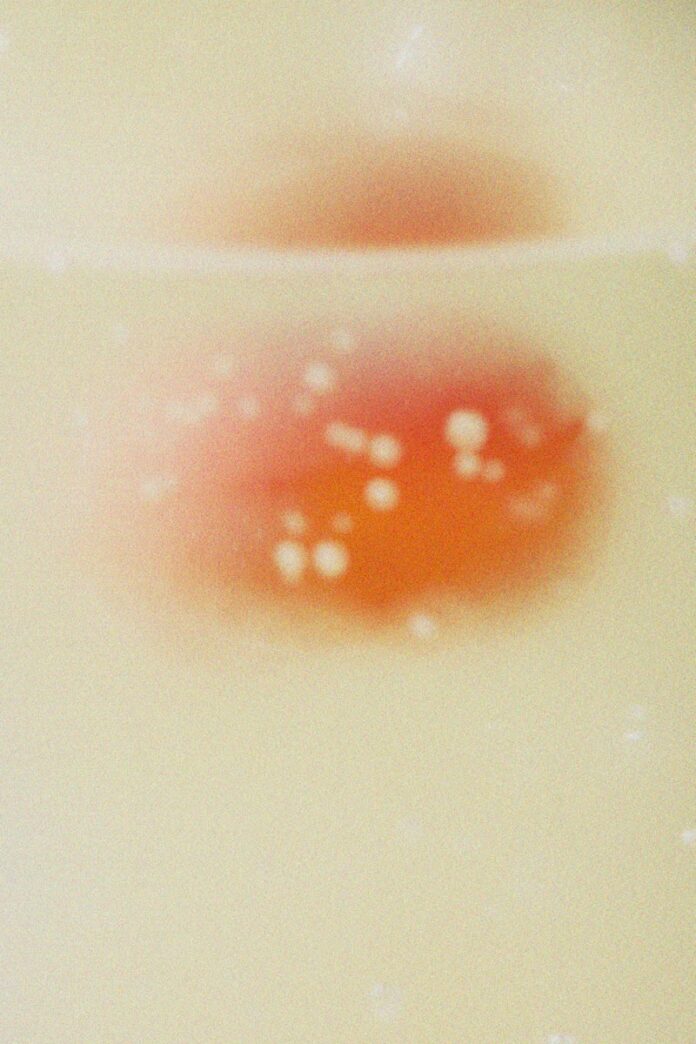 Photo by Pesce Huang A red and orange blob with white spots.